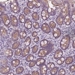 Invitrogen EPPK1 Polyclonal Antibody 100 &mu;L; Unconjugated:Antibodies,