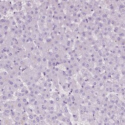 Invitrogen EPPK1 Polyclonal Antibody 100 &mu;L; Unconjugated:Antibodies,