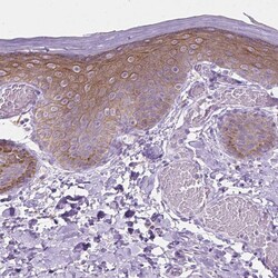 Invitrogen EPPK1 Polyclonal Antibody 100 &mu;L; Unconjugated:Antibodies,