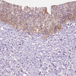 Invitrogen EPPK1 Polyclonal Antibody 100 &mu;L; Unconjugated:Antibodies,