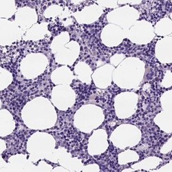 Invitrogen PEX12 Polyclonal Antibody 100 &mu;L; Unconjugated:Antibodies,