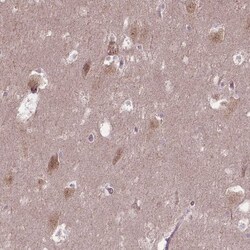 Invitrogen TMEM135 Polyclonal Antibody 100 &mu;L | Buy Online | Invitrogen&trade; | Fisher Scientific