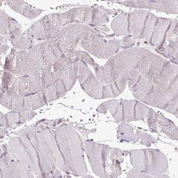 GLB1 Polyclonal Antibody, Invitrogen 100 &mu;L; Unconjugated:Antibodies,