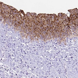 Invitrogen DHRS2 Polyclonal Antibody 100 &mu;L; Unconjugated:Antibodies,