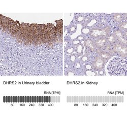 Invitrogen DHRS2 Polyclonal Antibody 100 &mu;L; Unconjugated:Antibodies,