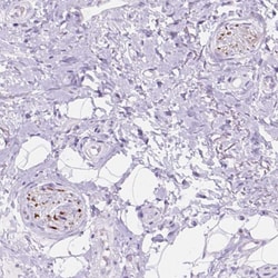 Invitrogen DCC Polyclonal Antibody 100 &mu;L; Unconjugated:Antibodies,