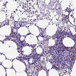 Invitrogen CD94 Polyclonal Antibody 100 &mu;L; Unconjugated:Antibodies,