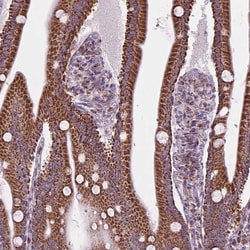 Invitrogen PYCRL Polyclonal Antibody 100 &mu;L; Unconjugated:Antibodies,