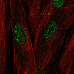 Invitrogen C17orf107 Polyclonal Antibody 100 &mu;L | Buy Online | Invitrogen&trade; | Fisher Scientific