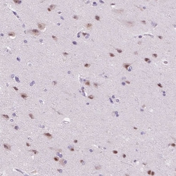 Invitrogen ZMAT4 Polyclonal Antibody 100 &mu;L; Unconjugated:Antibodies,