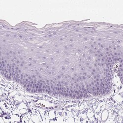 Invitrogen ZMAT4 Polyclonal Antibody 100 &mu;L; Unconjugated:Antibodies,