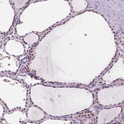 Invitrogen ZMAT4 Polyclonal Antibody 100 &mu;L; Unconjugated:Antibodies,
