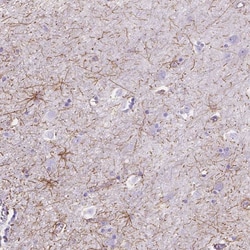 Invitrogen DMWD Polyclonal Antibody 100 &mu;L; Unconjugated:Antibodies,