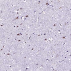 Invitrogen FAM124B Polyclonal Antibody 100 &mu;L; Unconjugated:Antibodies,