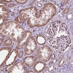 Invitrogen SCOC Polyclonal Antibody 100 &mu;L; Unconjugated:Antibodies,