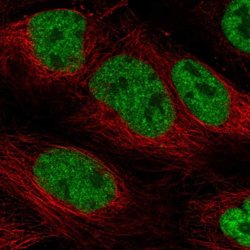 Invitrogen PHAX Polyclonal Antibody 100 &mu;L; Unconjugated:Antibodies,