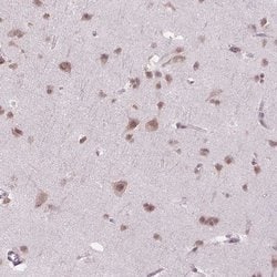 Invitrogen PHAX Polyclonal Antibody 100 &mu;L; Unconjugated:Antibodies,