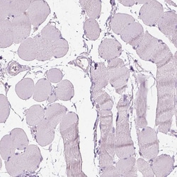 Invitrogen CD84 Polyclonal Antibody 100 &mu;L; Unconjugated:Antibodies,