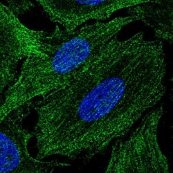 Invitrogen SPECC1L Polyclonal Antibody 100 &mu;L; Unconjugated:Antibodies,