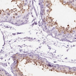 Invitrogen C1orf125 Polyclonal Antibody 100 &mu;L; Unconjugated:Antibodies,