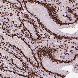 Invitrogen SMIM5 Polyclonal Antibody 100 &mu;L; Unconjugated:Antibodies,