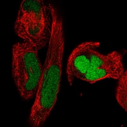 Invitrogen SMC2 Polyclonal Antibody 100 &mu;L; Unconjugated:Antibodies,