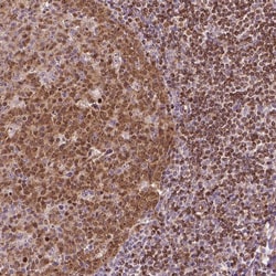 Invitrogen SMC2 Polyclonal Antibody 100 &mu;L; Unconjugated:Antibodies,