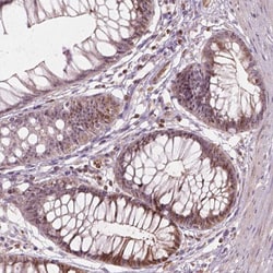 Invitrogen SMC2 Polyclonal Antibody 100 &mu;L; Unconjugated:Antibodies,
