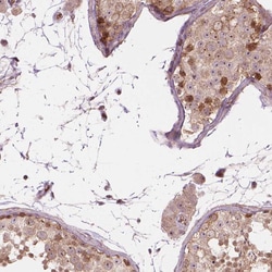 Invitrogen SMC2 Polyclonal Antibody 100 &mu;L; Unconjugated:Antibodies,