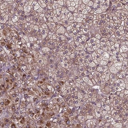 Invitrogen ZNF616 Polyclonal Antibody 100 &mu;L; Unconjugated:Antibodies,