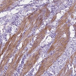 Invitrogen MBLAC1 Polyclonal Antibody 100 &mu;L; Unconjugated:Antibodies,