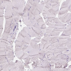 Invitrogen GAL3ST2 Polyclonal Antibody 100 &mu;L; Unconjugated:Antibodies,