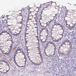 Invitrogen GAL3ST2 Polyclonal Antibody 100 &mu;L; Unconjugated:Antibodies,