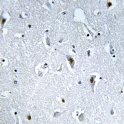 Phospho-HMGN2 (Ser29) Polyclonal Antibody:Antibodies, Polyclonal