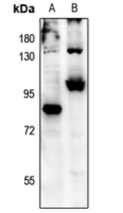 Invitrogen Phospho-FOXO3A (Ser315) Polyclonal Antibody 100 &mu;L; Unconjugated:Antibodies,