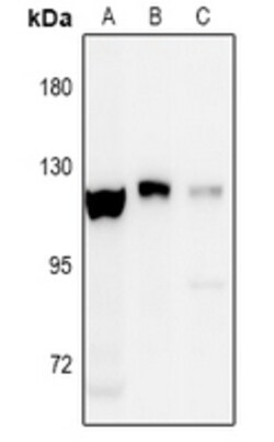 Invitrogen Phospho-EphA8 (Tyr838) Polyclonal Antibody 100 &mu;L; Unconjugated:Antibodies,