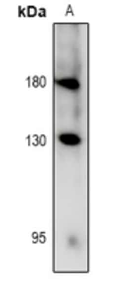 Invitrogen Phospho-RET (Tyr981) Polyclonal Antibody 100 &mu;L; Unconjugated:Antibodies,