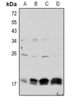 Invitrogen Phospho-Claudin 4 (Tyr208) Polyclonal Antibody 100 &mu;L; Unconjugated:Anticuerpos