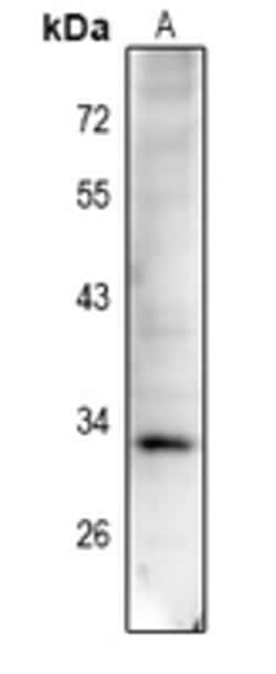 Invitrogen Phospho-Cyclin D1 (Thr288) Polyclonal Antibody 100 &mu;L | Buy Online | Invitrogen&trade; | Fisher Scientific