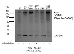 Invitrogen Phospho-RAD50 (Ser635) Polyclonal Antibody 100 &mu;L | Buy Online | Invitrogen&trade; | Fisher Scientific