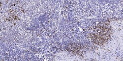 Invitrogen Phospho-VHL (Ser68) Polyclonal Antibody 100 &mu;L | Buy Online | Invitrogen&trade; | Fisher Scientific