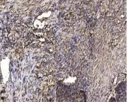 Invitrogen Phospho-DOK2 (Tyr345) Polyclonal Antibody 100 &mu;L | Buy Online | Invitrogen&trade; | Fisher Scientific