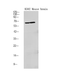 Invitrogen Phospho-PFKFB2 (Ser466) Polyclonal Antibody 100 &mu;L; Unconjugated:Antibodies,