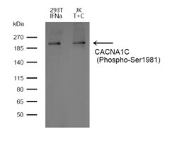 Invitrogen Phospho-CaV1.2 (Ser1981) Polyclonal Antibody 100 &mu;L | Buy Online | Invitrogen&trade; | Fisher Scientific
