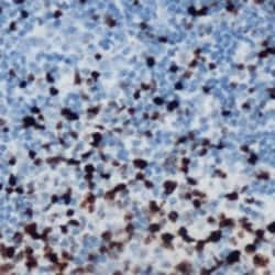 Invitrogen Phospho-ETS1 (Ser251) Polyclonal Antibody 100 &mu;L | Buy Online | Invitrogen&trade; | Fisher Scientific