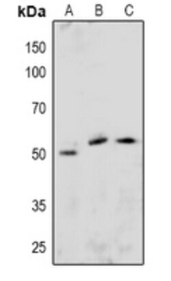 Invitrogen Phospho-ETS1 (Ser251) Polyclonal Antibody 100 &mu;L | Buy Online | Invitrogen&trade; | Fisher Scientific