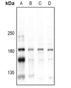 Invitrogen Phospho-CD45 (Tyr1216) Polyclonal Antibody 100 &mu;L | Buy Online | Invitrogen&trade; | Fisher Scientific