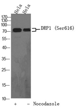 Invitrogen Phospho-DRP1 (Ser616) Polyclonal Antibody 100 &mu;L; Unconjugated:Antibodies,