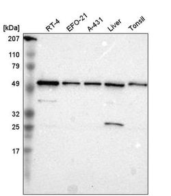 Invitrogen TOM1 Polyclonal Antibody 100 &mu;L | Buy Online | Invitrogen&trade; | Fisher Scientific