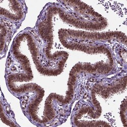 Invitrogen ZNF630 Polyclonal Antibody 100 &mu;L; Unconjugated:Antibodies,